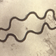 A scanning electron microscopic (SEM) image of two Treponema pallidum bacteria, the germ responsible for syphilis